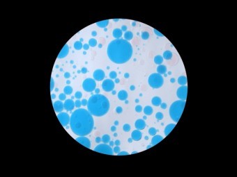 拡大したカビの粒子